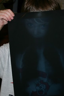 X is for X-Ray